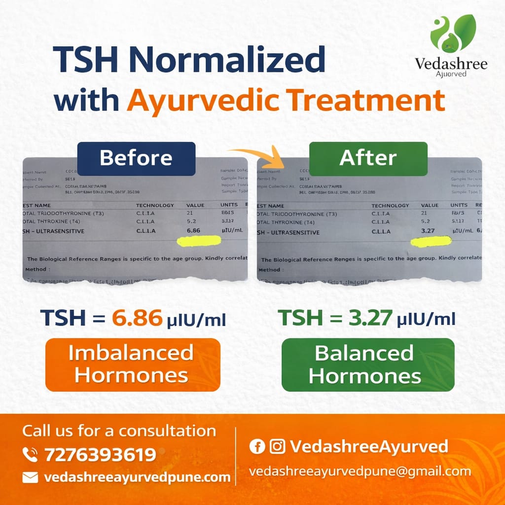 Thyroid Management with Ayurveda: Significant TSH Reduction in Just 1 Month